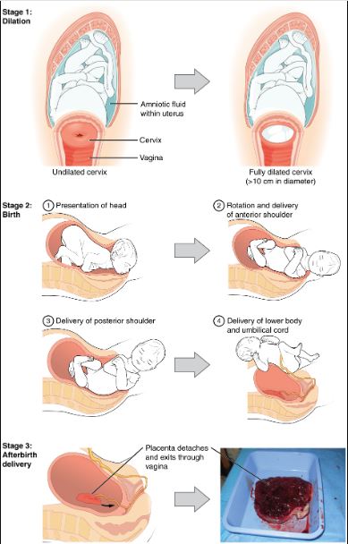 Labor and Delivery tips